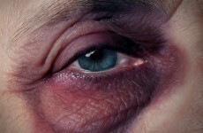 Call for vigilance as elder abuse in Ireland on the increase