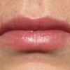 Woman accidentally superglues lips together