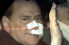 Surgery for Berlusconi after 2009 statuette attack