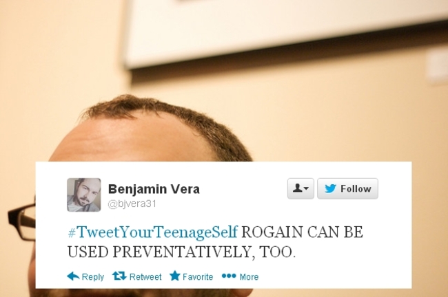 hairline