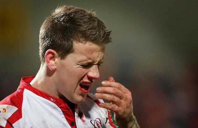 Craig Gilroy leaves the pitch with an injury