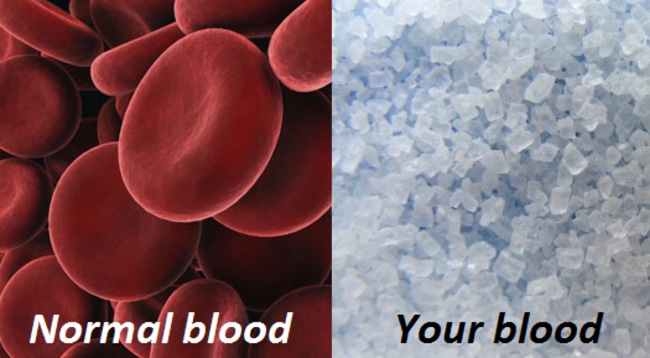 bloodsugars