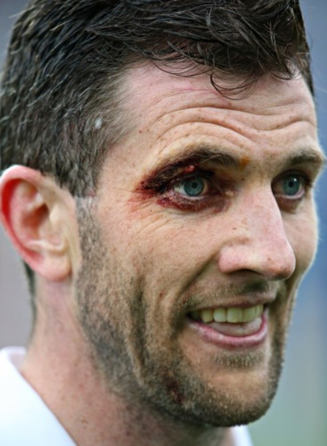 Donal O&Otilde;Grady