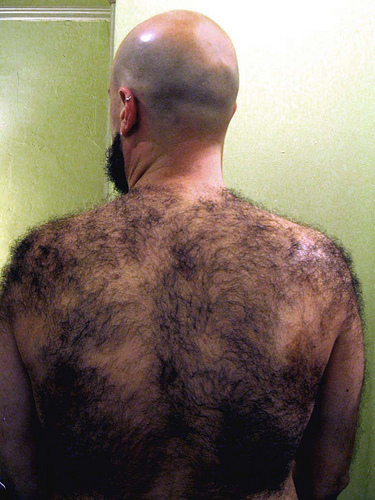 Men why backs some hairy do have How Common