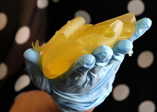 No need to remove intact implants
