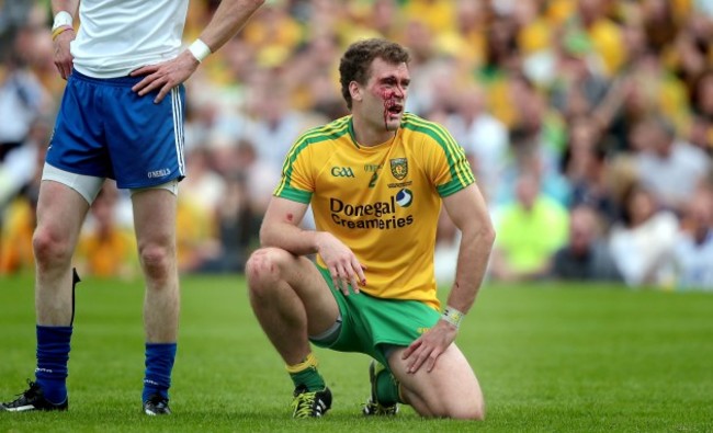 Eamon McGee injured