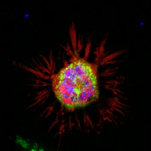 Parkin-Induced Cell Death II