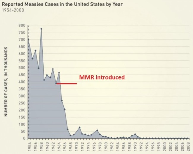 Measles