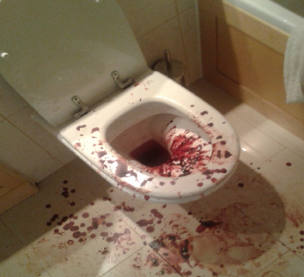 toilet murder scenes clean needles drug cleaning complaining job guys dens thejournal ie