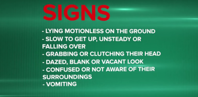 signs of concussion