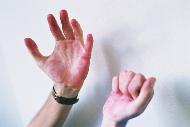 Beetroot Hands