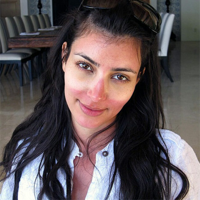 1358461515_kim-kardashian-sunburn-467