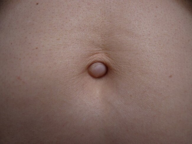 Belly Button in Morning Light