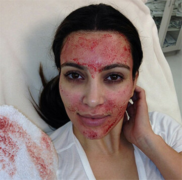 kimkdracula