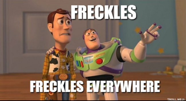 freckles-freckles-everywhere