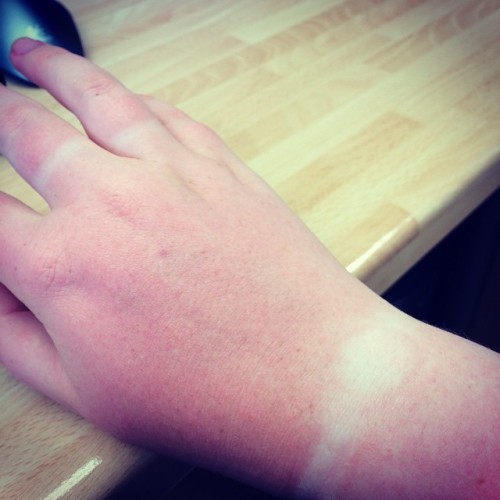 Oh dear. #tanlines #idiot