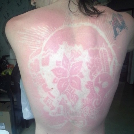 That awful sunburn actually turned out to be pretty badass but still hurts like a MF #sunburn #ouch #sunburnart
