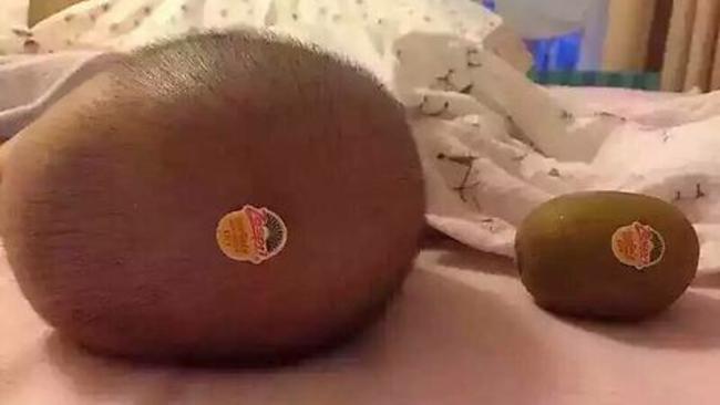 Kiwi for scale