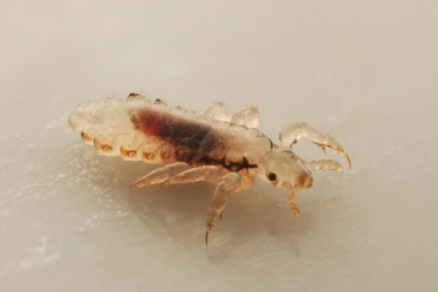 What to do if your child's hair gets infested with head lice