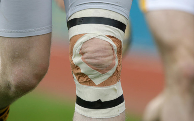 A general view of a knee injury