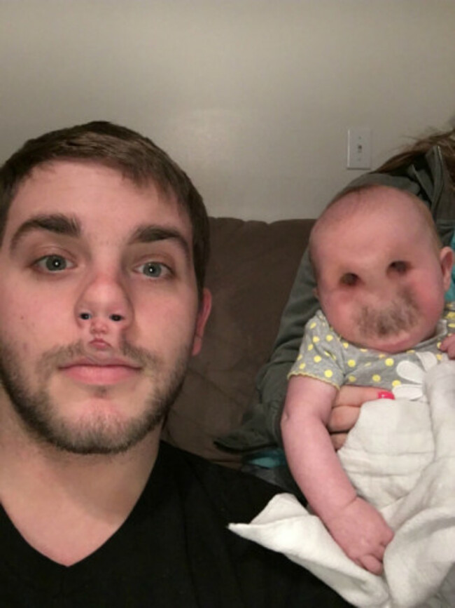 faceswap