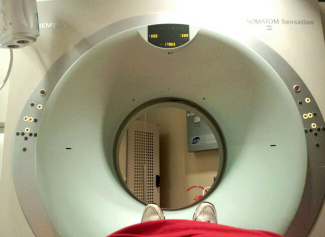 CT Scan