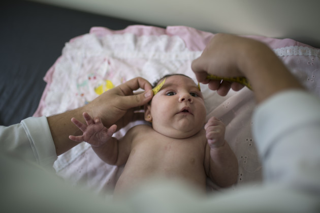 Brazil Zika Birth Defects