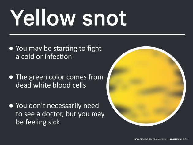 what-does-it-mean-when-i-have-green-or-yellow-mucus