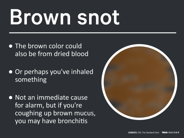 here-s-what-the-color-of-your-snot-really-means-yellow-snot-yellow