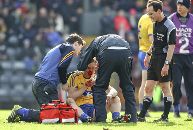 Niall Daly sustains a facial injury