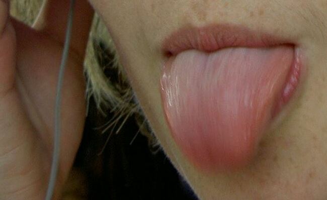 tongue