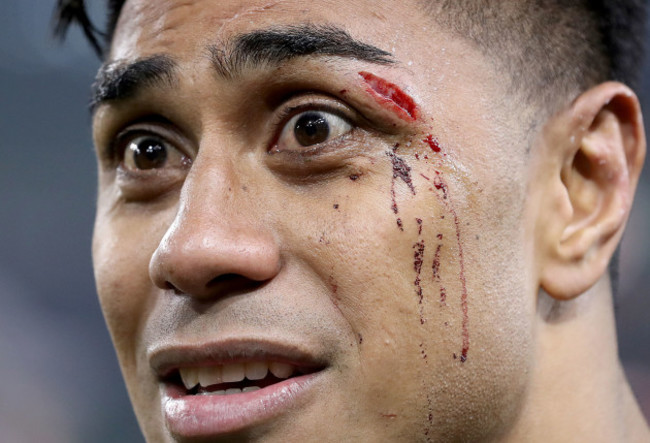 Malakai Fekitoa after the game