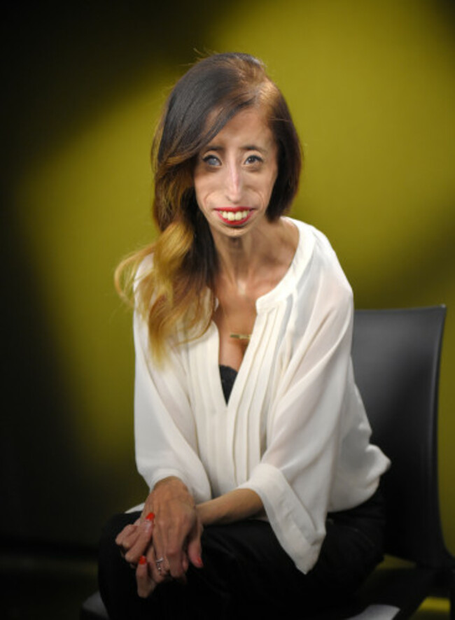 Film-Lizzie Velasquez