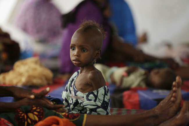 Nigeria Starving Children