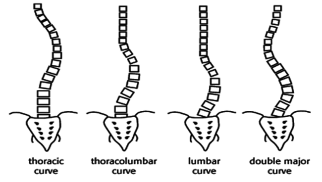 Scoliosis Spine