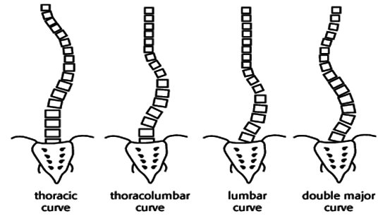 Scoliosis Spine