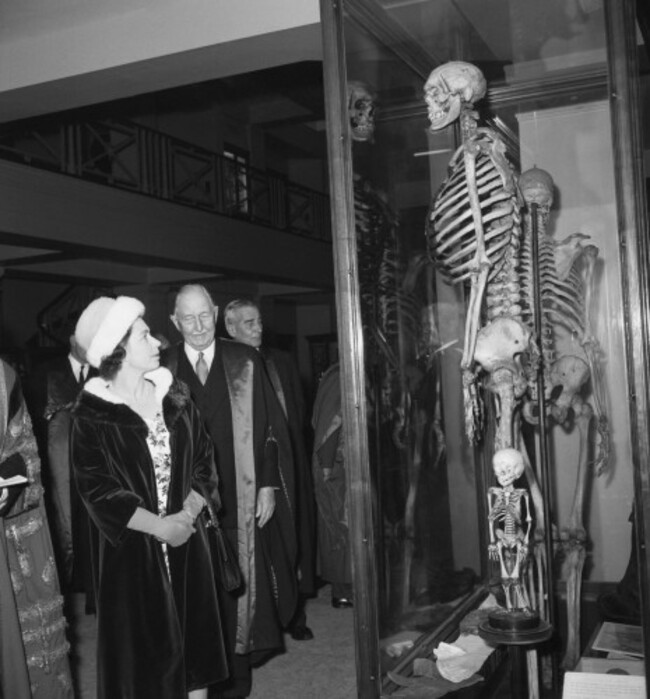 Royalty - The Queen meets the Irish Giant - Hunterian Museum, London