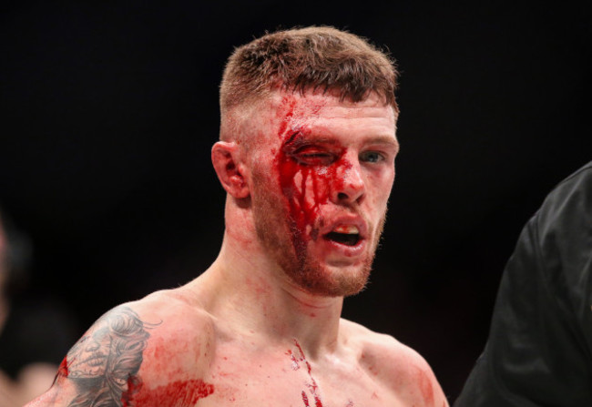 Darren O'Gorman sports a cut during the fight