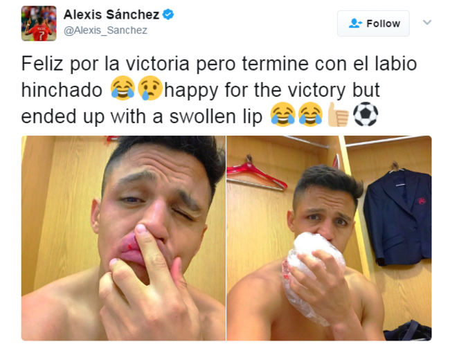 sanchez