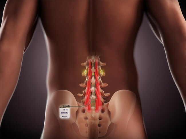 ReActive_the_product