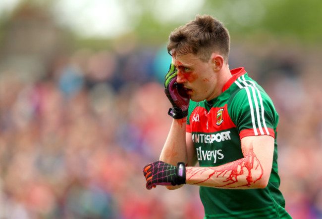 Diarmuid O'Connor injured