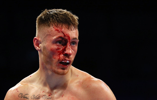 Lee Haskins v Ryan Burnett - Odyssey Arena Belfast