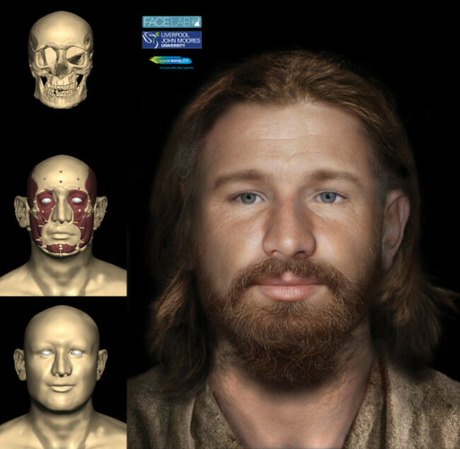 TCD Facial Reconstruction