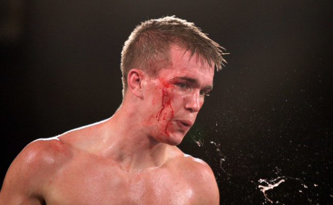 A bloodied Jamie Kavanagh