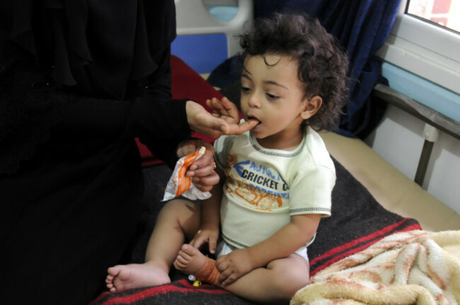 YEMEN-SANAA-CHOLERA-OVER 300,000 PEOPLE
