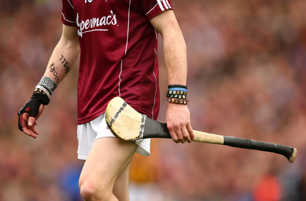 General view of Conor Whelan arm's