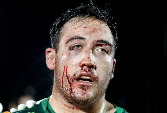 Denis Buckley with a bloodied face after the game