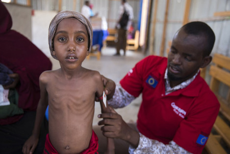 Yasmiin (5) when she weighed just 12.5kg in March being treated by Hashim Jelle at a Concern Worldwide centre in Mogadishu