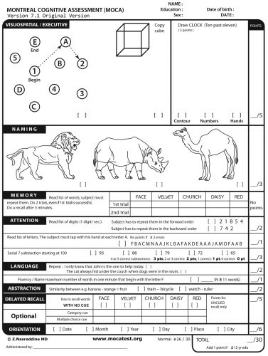 Could You Pass The Cognitive Fitness Test Taken By Donald Trump This Week