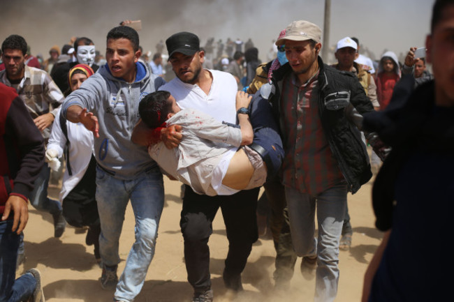 MIDEAST-GAZA-CLASHES